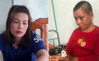 Vụ cô gái trẻ tố bị tra tấn: Đối tượng từng là tay anh chị trong giới giang hồ?
