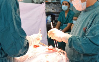 Ruột bỗng dưng tím đen, tính mạng người phụ nữ 32 tuổi cùng đứa con sắp chào đời lâm nguy