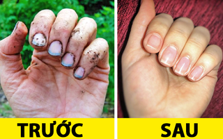 9 mẹo "chữa cháy" thần tốc giúp chị em cải thiện ngoại hình trong nháy mắt
