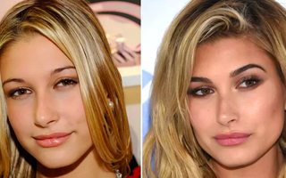 Nhan sắc thay đổi nhờ "dao kéo" của Hailey Baldwin - chân dài vừa đính hôn với Justin Bieber