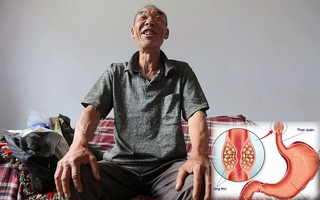 Bí quyết chiến thắng căn bệnh ung thư thực quản của lão nông 64 tuổi, sống hơn 16 năm sau ca phẫu thuật