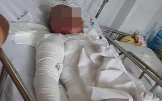 Bi kịch của người phụ nữ “hai lần đò” bị chồng thiêu sống