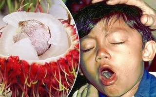 Hạt chôm chôm - Lại thêm 1 hung thần khiến bé trai 7 tuổi hóc nghẹn và mất mạng