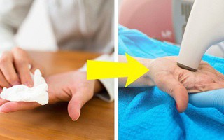 5 dấu hiệu cảnh báo những căn bệnh nguy hiểm thông qua đôi bàn tay của bạn