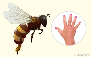 Hướng dẫn cách nhận biết bạn bị con côn trùng nào cắn qua hình dạng của 10 vết cắn