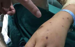 Người mẹ xả thân hứng chịu hơn 230 vết ong đốt để bảo vệ 2 con nhỏ