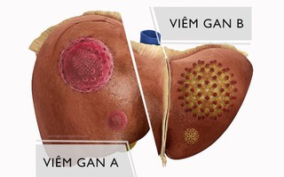 BS khuyên: Đừng dùng thuốc bổ, chỉ cần làm mấy việc này là gan luôn khỏe mạnh và ít bệnh