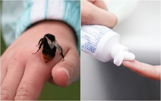 Cô bé 5 tuổi tử vong vì ong đốt, nguyên nhân do sự chủ quan khi sơ cứu của cha mẹ