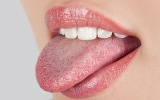 Những dấu hiệu bất thường ở vùng lưỡi cảnh báo một số vấn đề sức khỏe mà bạn không hề hay biết