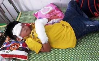 Điện thoại phát nổ lúc đang xạc pin, cháu bé 7 tuổi bị dập nát tay