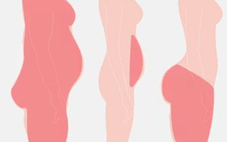 Béo bụng, to đùi, xệ mông và cách "điều trị" hiệu quả