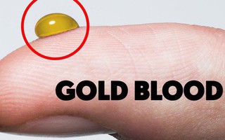 Kinh ngạc với nhóm máu được ví với "vàng ròng", và chỉ 43 người trên thế giới có nó