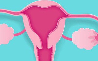 7 nguyên nhân gây ung thư buồng trứng bạn phải biết