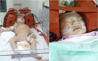 Chia sẻ hình ảnh đau lòng của con, bà mẹ khẩn thiết kêu gọi mọi người không mắc phải sai lầm này khi đi ô tô