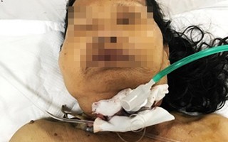 Quảng Nam: Bà bị dao đâm xuyên cổ khi phụ cháu làm gà ăn