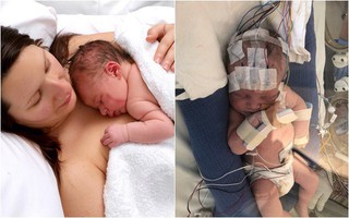 Cả thai kì hoàn toàn khỏe mạnh nhưng khi vừa đặt con mới sinh lên người, bà mẹ đã linh cảm điều không ổn