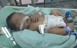 Bé gái 32 tuần tuổi bị mẹ phá thai để chối bỏ, được nhóm thiện nguyện khi đi nhặt xác thai nhi cứu sống