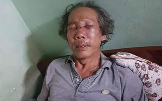 Bảo vệ chung cư Sài Gòn đánh ông già 68 tuổi rách mặt, gãy sống mũi vì đậu xe sai quy định