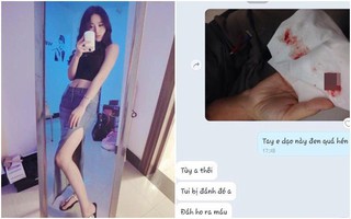 Cô nàng giở chiêu giả mắc bệnh nan y, sắp "ra đi" để chia tay bạn trai, hẹn hò người mới