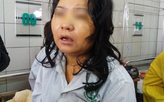 Một phụ nữ nguy kịch, xơ gan nghi do sử dụng thực phẩm chức năng để giảm cân