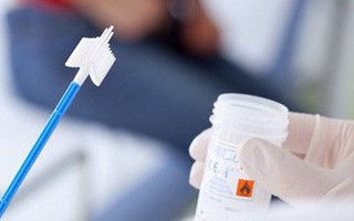 Phát hiện sớm ung thư cần làm các xét nghiệm nào?
