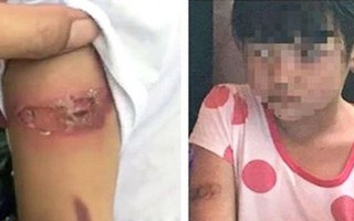 Bé gái bị bố đẻ mẹ kế bạo hành "biến mất": Chính quyền xã phải chịu trách nhiệm