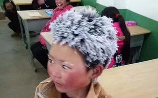 Cậu bé "tóc đóng băng" được quyên góp hơn 1 tỷ đồng nhưng chỉ nhận 28 triệu, lý do thực sự sẽ khiến bạn thấy ấm lòng