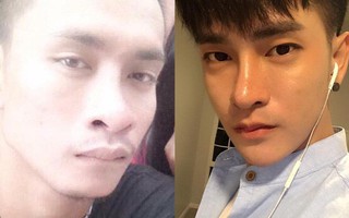 Sửa mặt thành nghiện, "Lệ Rơi phiên bản Thái Lan" chi bộn tiền, phẫu thuật 30 lần để giống soái ca Hàn Quốc