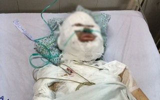 Vụ cô gái bị người đàn ông ngoại quốc tẩm xăng đốt: ‘Con chưa bao giờ kể tôi nghe về người này’