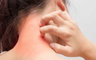 Giới trẻ đang ngày càng già trước tuổi chỉ vì một thói quen hầu như ai cũng mắc phải