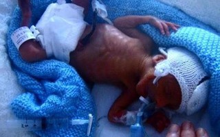 Mang thai nhưng vẫn chủ quan uống rượu, đến ngày sinh mẹ sốc nặng khi nhìn thấy con và không ngừng hối hận