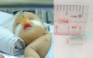 Hiểm họa khôn lường: Mẹ mua kèn cho con chơi, ba ngày sau đứa trẻ tím tái, thở ra tiếng kèn và ngưng tim