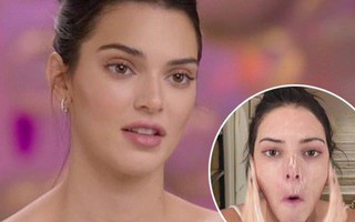 Toàn cảnh vụ thảm họa quảng cáo kem trị mụn đang khiến Kendall Jenner hứng đủ "gạch đá" xây biệt thự