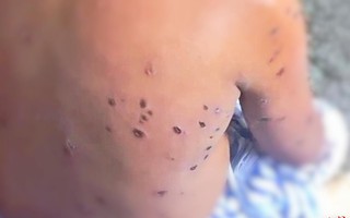 Ông bố làm đồng mãi chưa về, gia đình lo lắng đi tìm thì phát hiện bất tỉnh giữa đường và khiếp sợ trước vết thương do ong tấn công