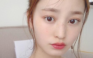 Đây là dấu hiệu cho thấy làn da đang bị tổn thương, bạn không cứu ngay thì da đã xấu càng thêm xấu