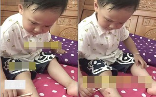Không may bị thương chảy máu, cậu bé 3 tuổi bình tĩnh tự lau vết thương, còn an ủi ngược mẹ 1 câu khiến dân mạng khen rầm rầm 