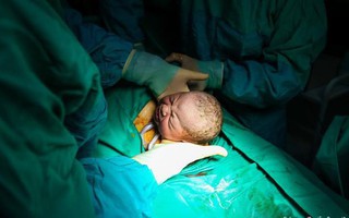 Trải nghiệm kinh hoàng của bà mẹ khi đang sinh mổ mà thuốc gây tê tủy sống không có tác dụng
