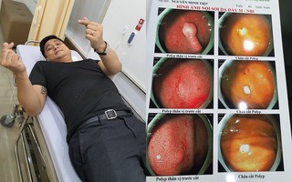 Bệnh polyp đại tràng và polyp dạ dày mà diễn viên Minh Tiệp vừa phát hiện có thể tiến triển thành ung thư không?