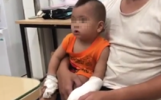 Tai nạn kinh hoàng: Người nhà thử xe máy mới mua, bé trai 1 tuổi bị đứt lìa 4 ngón tay