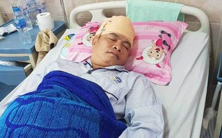 Bị đánh xuất huyết não vì vay tín dụng đen ở Sài Gòn