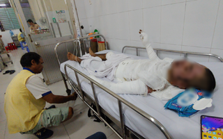 Bị vợ đuổi khỏi nhà, người chồng 23 tuổi quẫn trí mua xăng về tự thiêu khiến cơ thể bỏng nặng