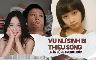 “Cả gan" cự tuyệt tình cảm của đại thiếu gia, nữ sinh xinh đẹp bị thiêu sống, hủy hoại cuộc đời, hung thủ lãnh án nhẹ nhàng nhờ gia thế khủng