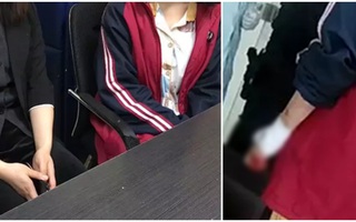 Tìm việc làm trên mạng, nữ sinh viên năm tư phải cắt cổ tay của chính mình chỉ vì một nguyên nhân đáng sợ