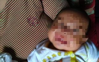 Bà mẹ kinh hoàng chứng kiến cảnh con gái 1 tháng tuổi bị chuột cắn ngay trên giường