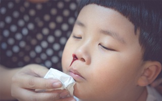 Ai cũng bắt trẻ ngửa đầu ra sau khi chảy máu cam nhưng chuyên gia lại khuyên bố mẹ làm việc khác