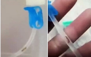 Đi chữa bệnh cúm, gặp phải con sâu trong ống truyền dịch