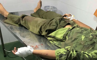 Hãi hùng lời kể của cán bộ kiểm lâm bị hơn 20 lâm tặc vây chém để giải vây đồng bọn