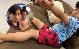 Ngọc Lan có động thái gay gắt khi phát hiện những vết đỏ chi chít trên người con trai sau khi đi chơi với bố