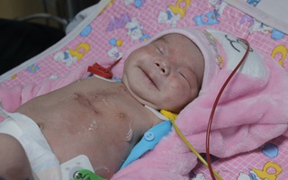 TP.HCM: Mổ khẩn cứu bé sơ sinh nguy kịch trong bụng mẹ vì động mạch phổi nằm sai vị trí