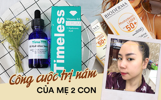 Mẹ 2 con chia sẻ quá trình trị thâm nám sau sinh: Peel da để trị nám, nhưng quan trọng nhất vẫn là bước skincare phục hồi